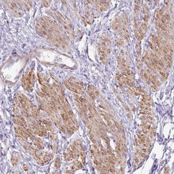 DIP2A Antibody, Novus Biologicals:Antibodies:Primary Antibodies